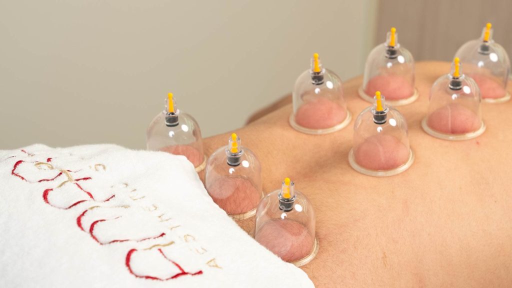 Hijama Therapy in Dubai at Amara Aesthetic Studio