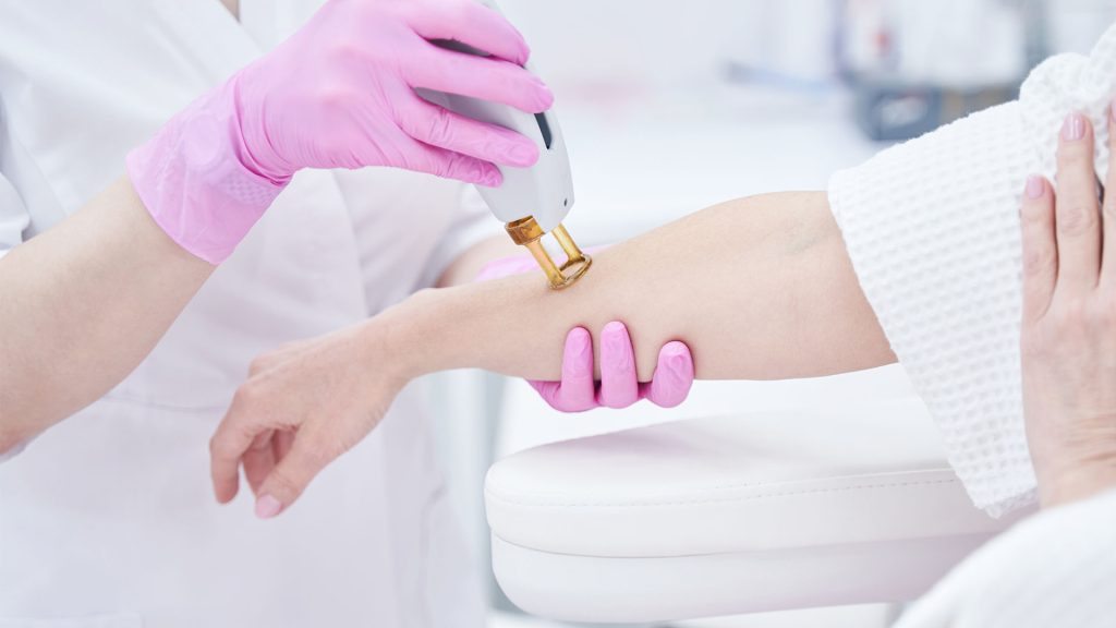 An expert performing laser hair removal using a hair removal machine.