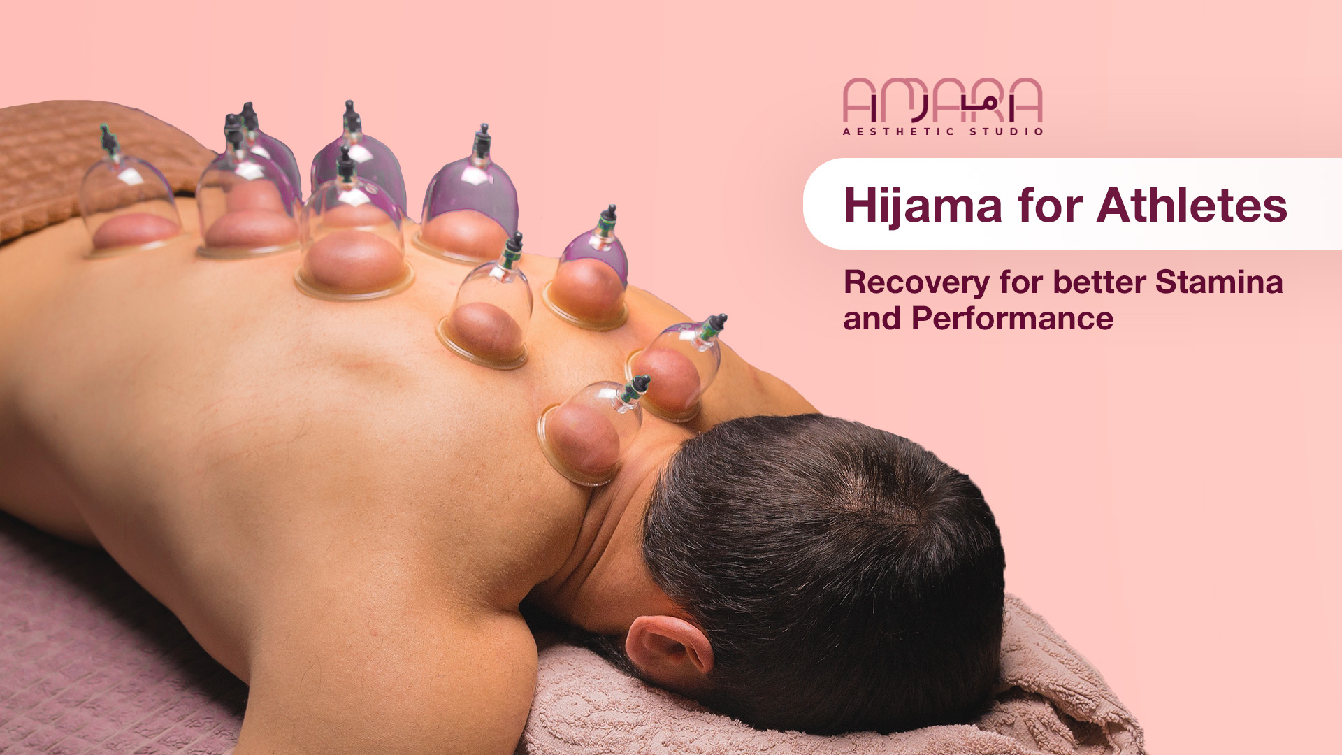 Hijama for Athletes: Recovery, Stamina, and Performance