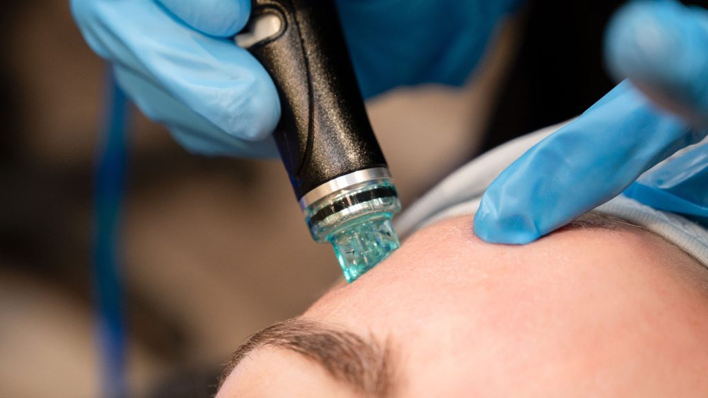 How Manual Extractions Complement Treatments Like HydraFacials