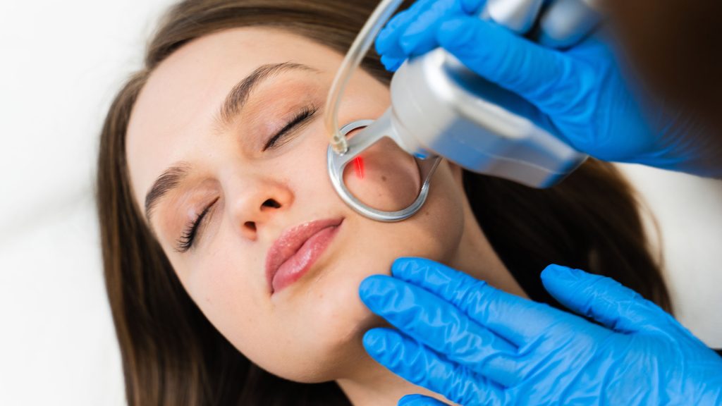 acne scar removal Dubai