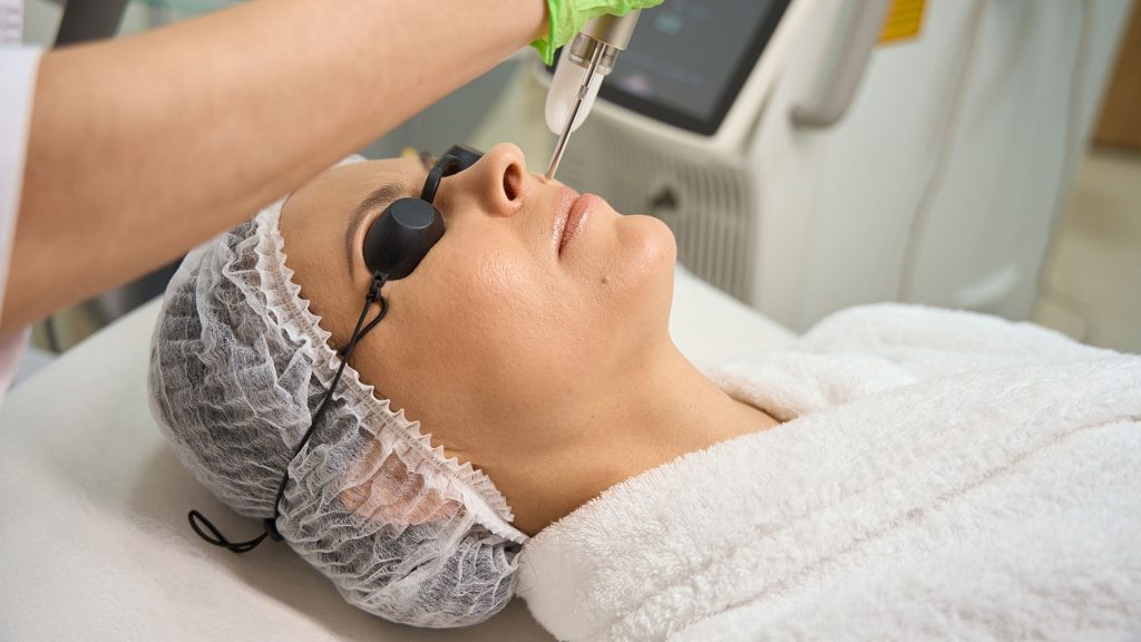 When to Prefer Laser Skin Rejuvenation