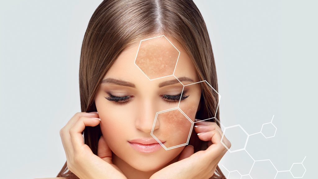 Deep Dermal Pigmentation