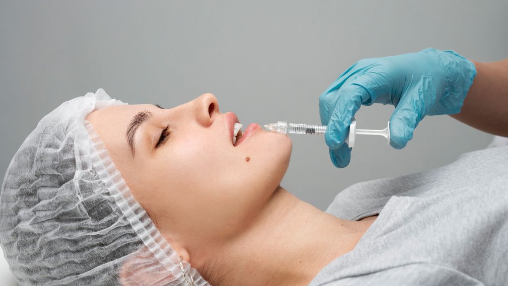 Dermal Fillers