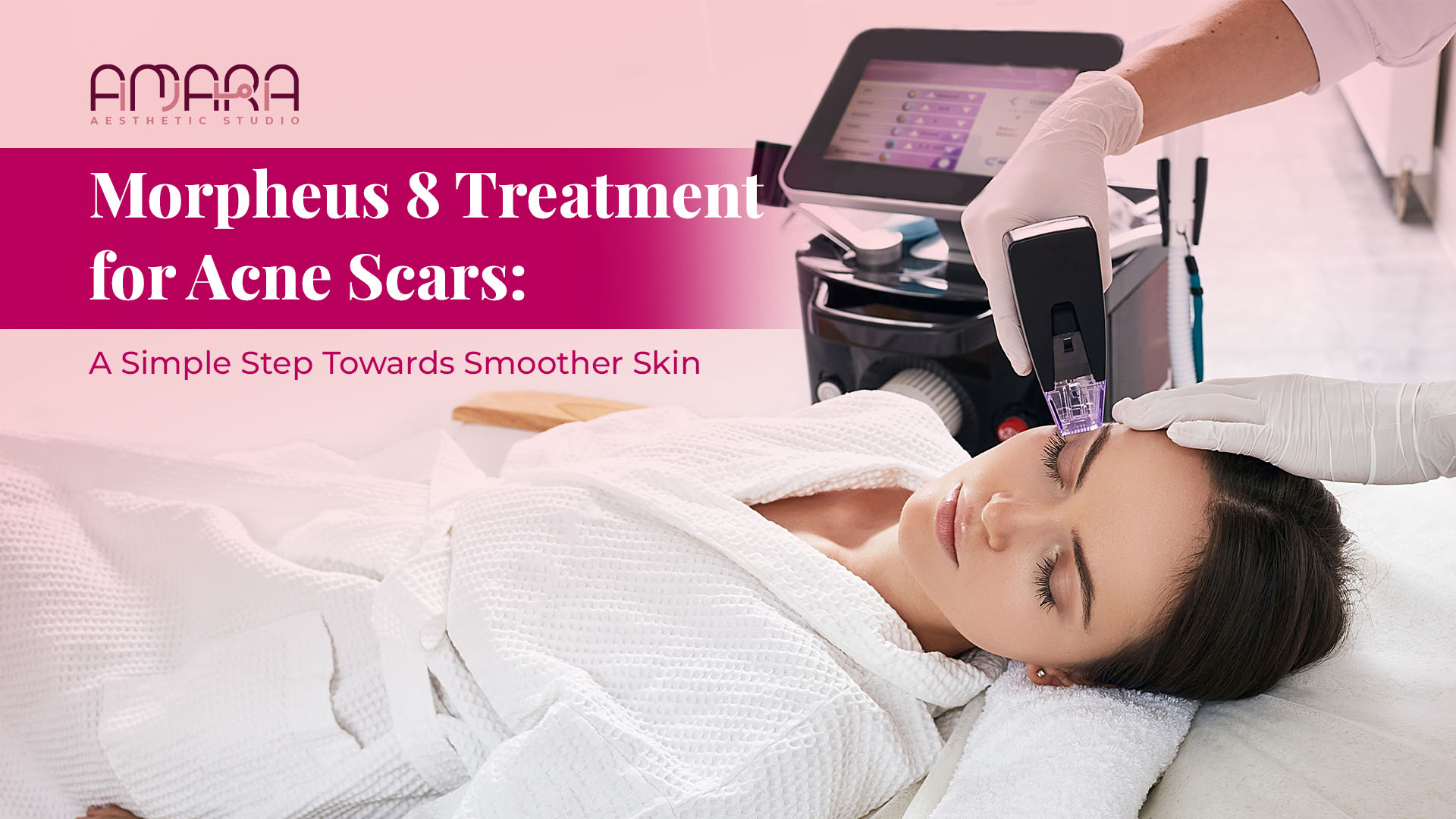 Morpheus 8 Treatment for Acne Scars: A Simple Step Towards Smoother Skin