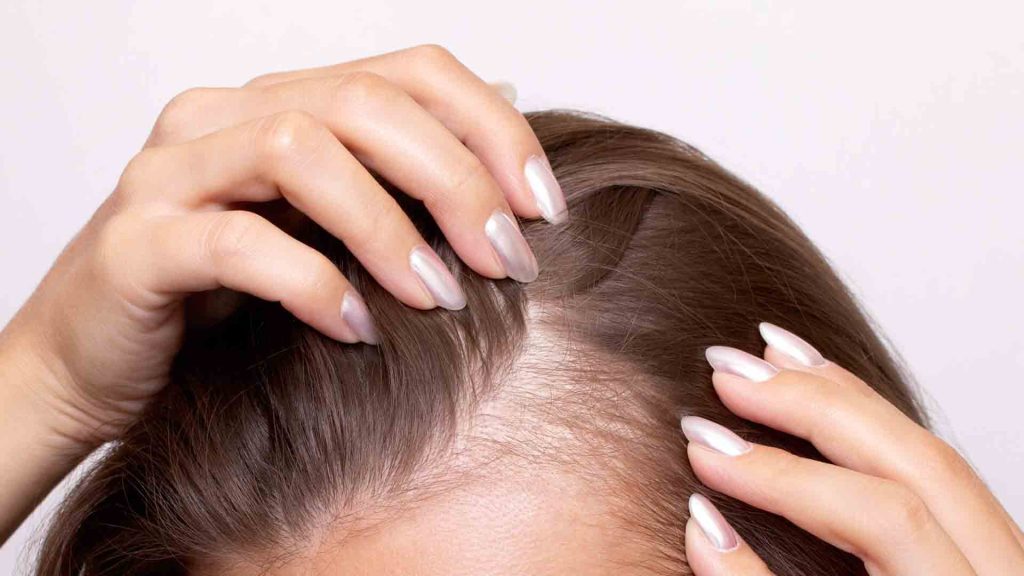 Hair and Scalp Health Finally Getting the Attention It Deserves