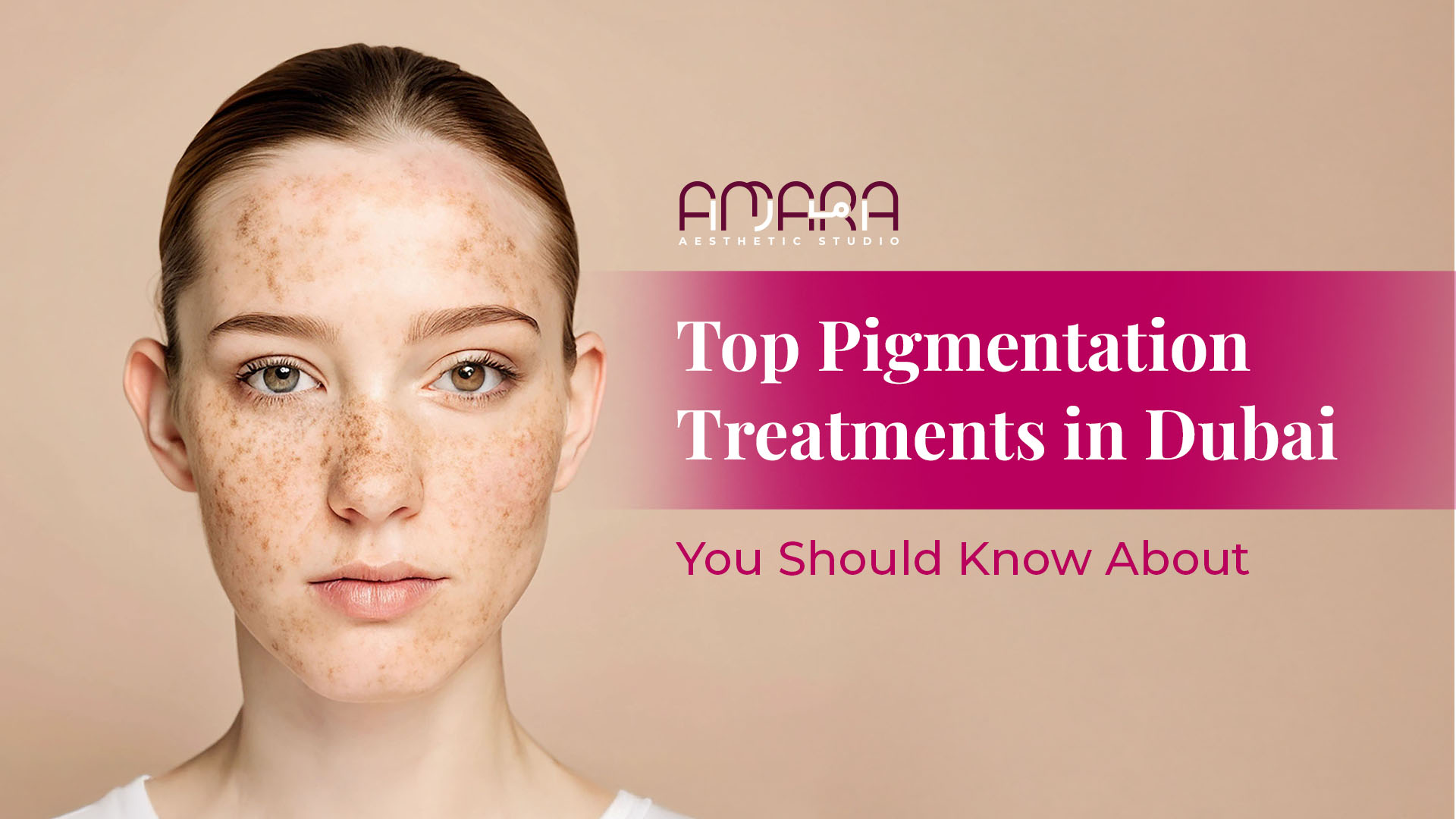 Top Pigmentation Treatments in Dubai You Should Know About