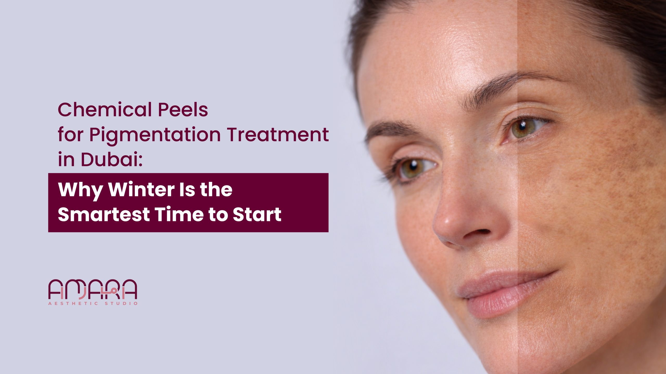 Chemical Peels for Pigmentation Treatment in Dubai: Why Winter Is the Smartest Time to Start