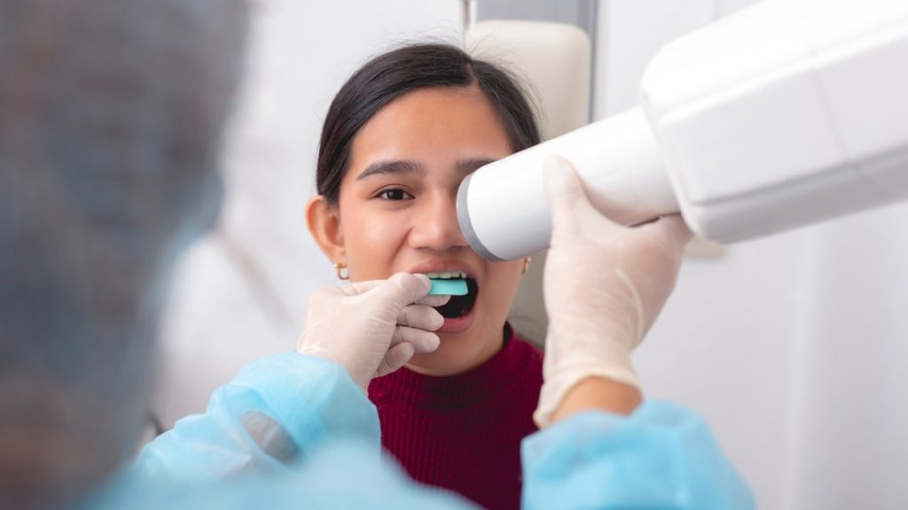 How Digital Dental X-Rays in Dubai Improve Diagnosis and Treatment