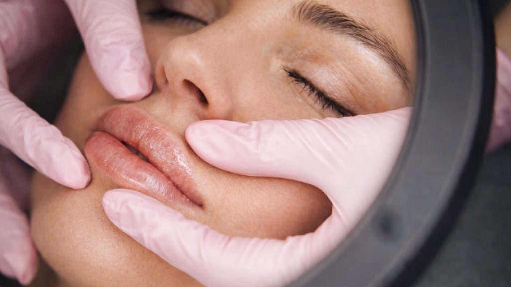 Commonly Used Lip Fillers for Natural-Looking Results
