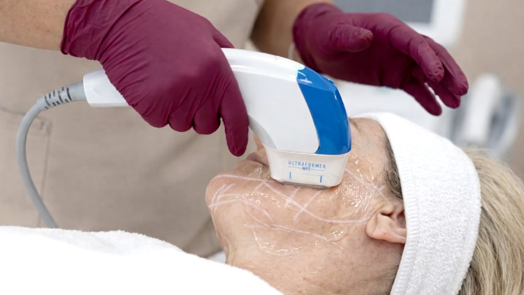 Top Benefits of Non-Surgical Facelifts