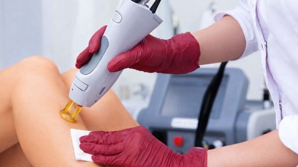 Laser Hair Removal