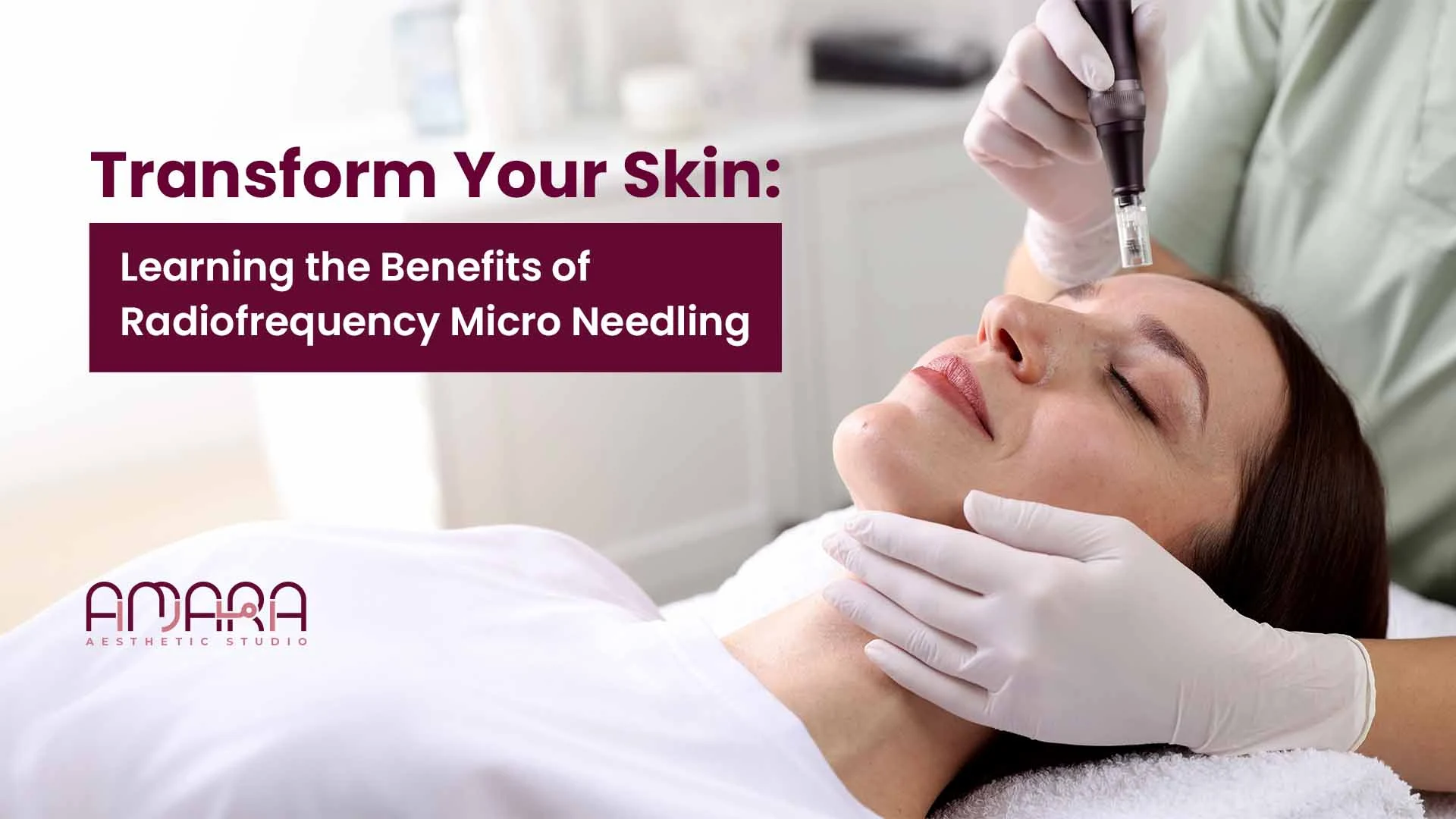 Transform Your Skin: Benefits of Radiofrequency Micro Needling 
