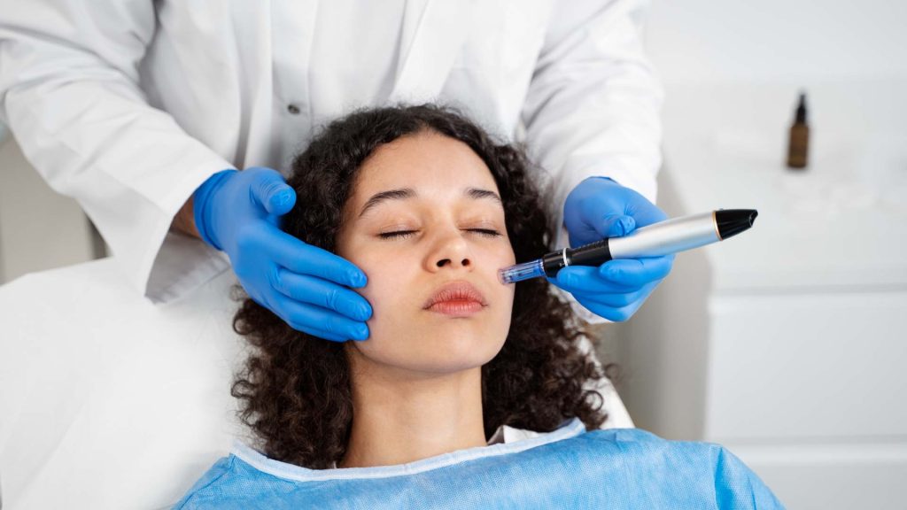 Laser pigment removal treatment for clear and even skin tone