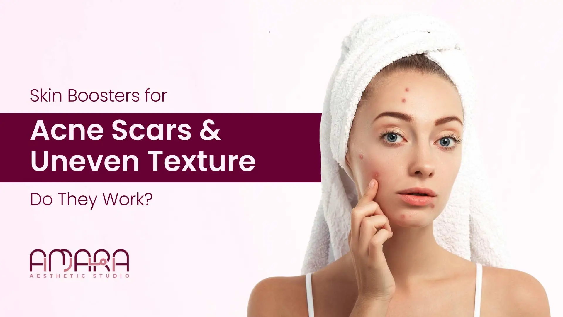 Skin Boosters for Acne Scars & Uneven Texture: Do They Work?